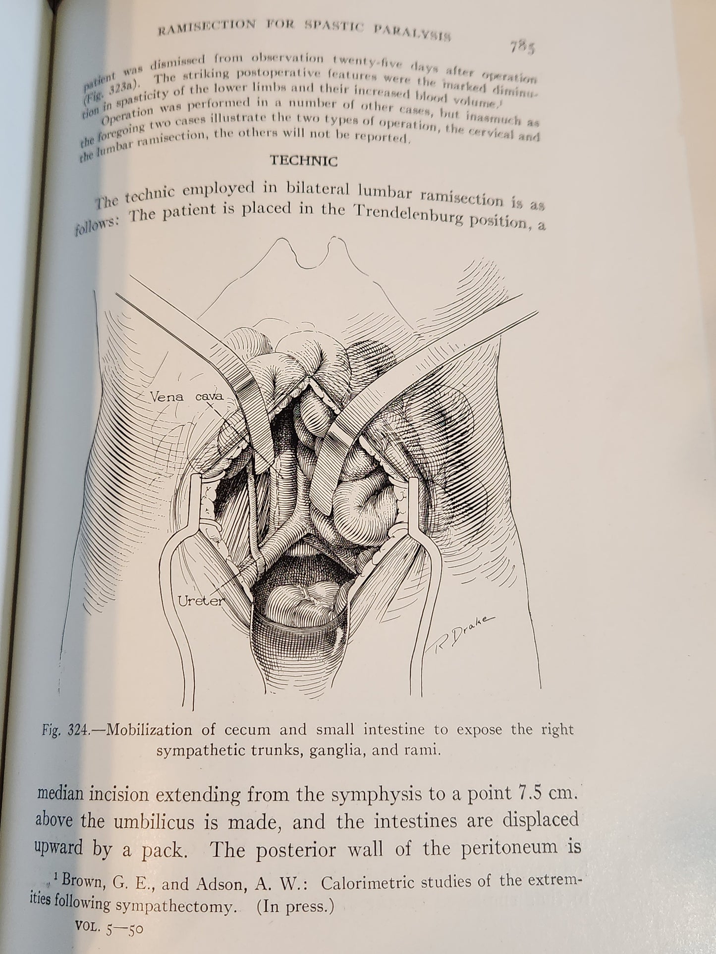 The Surgical Clinics of North America - June, 1925 – Volume 5, Number 3 (Mayo Clinic Issue)