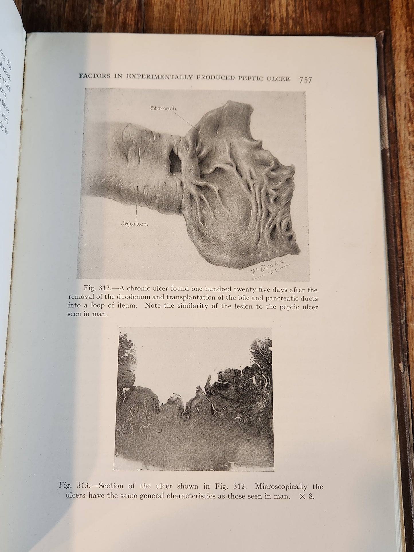 The Surgical Clinics of North America - June, 1925 – Volume 5, Number 3 (Mayo Clinic Issue)